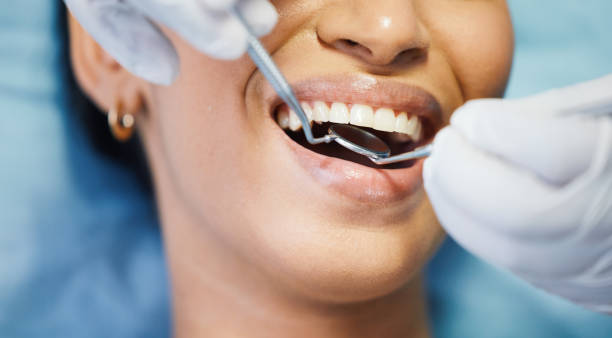 Best Emergency Dentist for Knocked-Out Tooth in Wilberforce, OH