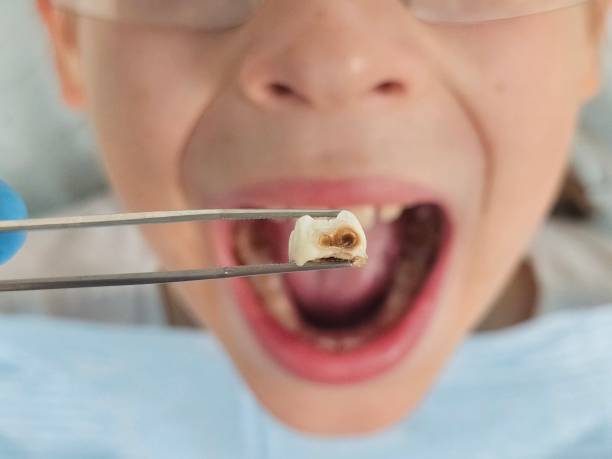 Best Orthodontic Emergency Dentist in Wilberforce, OH